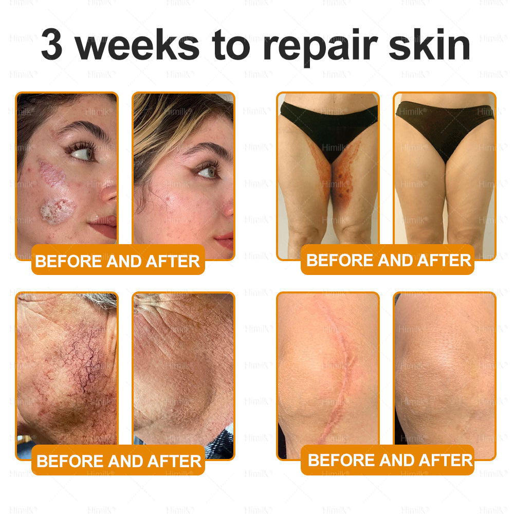 𝑯𝙞𝒎𝙞𝙡𝒌® ---One last chance! Grab this lucky find at 50% OFF!🔥180-day money back guarantee! Free air shipping!