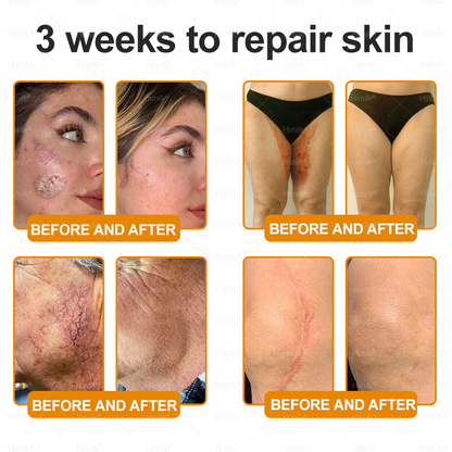 𝑯𝙞𝒎𝙞𝙡𝒌® ---One last chance! Grab this lucky find at 50% OFF!🔥180-day money back guarantee! Free air shipping!