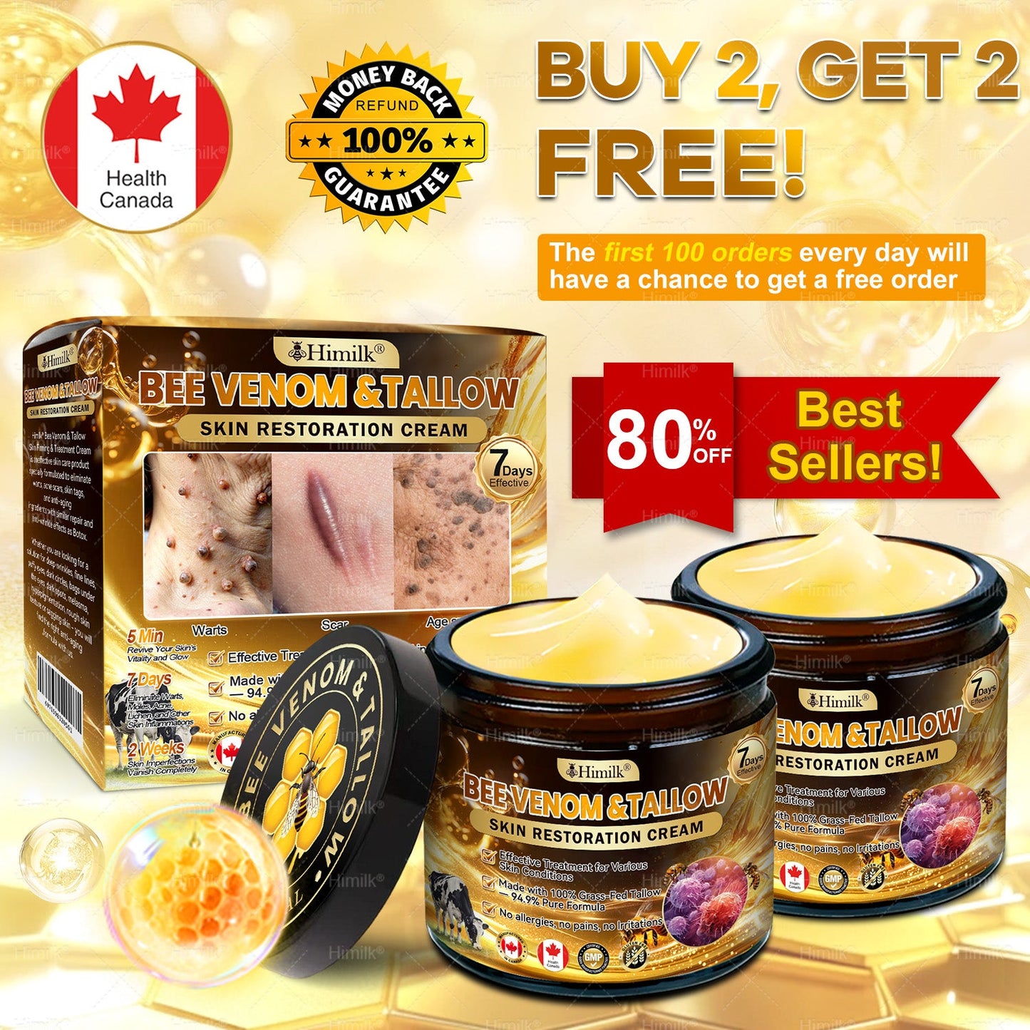 𝐇𝐢𝒎𝒊𝙡𝙠® 𝐁𝐞𝐞 𝑽𝒆𝒏𝒐𝒎 &  𝙏𝙖𝙡𝙡𝙤𝙬 𝗦𝗸𝐢𝐧 𝙍𝙚𝙨𝙩𝒐𝒓𝒂𝒕𝐢𝐨𝐧 𝗖𝗿𝗲𝐚𝐦 –🌸 𝖠𝗇𝗍𝗂-𝖺𝗀𝗂𝗇𝗀,𝖧𝗒𝖽𝗋𝖺𝗍𝗂𝗇𝗀, 𝖲𝗄𝗂𝗇 𝖱𝖾𝗉𝖺𝗂𝗋, 𝖤𝗏𝖾𝗇 𝖳𝗈𝗇𝖾, 𝖠𝖼𝗇𝖾 𝖺𝗇𝖽 𝖣𝖺𝗋𝗄 𝖲𝗉𝗈𝗍 𝖳𝗋𝖾𝖺𝗍𝗆𝖾𝗇𝗍, 𝖶𝖺𝗋𝗍 𝖺𝗇𝖽 𝖬𝗈𝗅𝖾 𝖱𝖾𝗆𝗈𝗏𝖺𝗅, 𝖯𝗌𝗈𝗋𝗂𝖺𝗌𝗂𝗌 𝖱𝖾𝗅𝗂𝖾𝖿