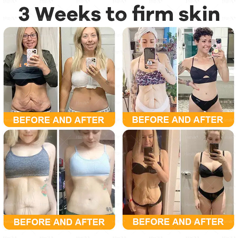 𝑯𝙞𝒎𝙞𝙡𝒌® ---One last chance! Grab this lucky find at 50% OFF!🔥180-day money back guarantee! Free air shipping!