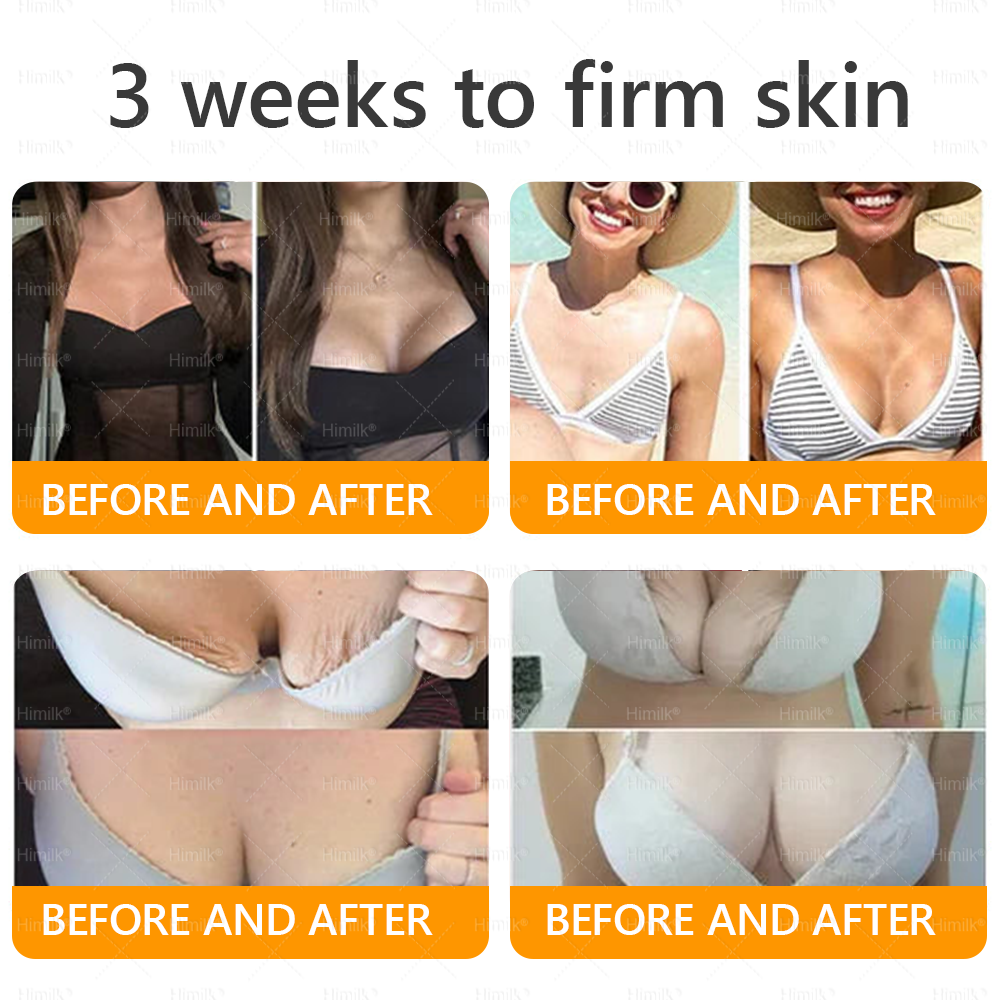 𝑯𝙞𝒎𝙞𝙡𝒌® ---One last chance! Grab this lucky find at 50% OFF!🔥180-day money back guarantee! Free air shipping!