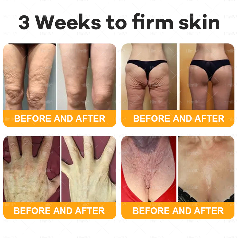 𝑯𝙞𝒎𝙞𝙡𝒌® ---One last chance! Grab this lucky find at 50% OFF!🔥180-day money back guarantee! Free air shipping!