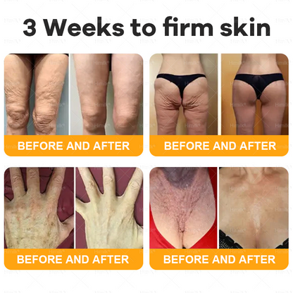 𝑯𝙞𝒎𝙞𝙡𝒌® ---One last chance! Grab this lucky find at 50% OFF!🔥180-day money back guarantee! Free air shipping!