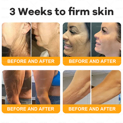 𝑯𝙞𝒎𝙞𝙡𝒌® ---One last chance! Grab this lucky find at 50% OFF!🔥180-day money back guarantee! Free air shipping!