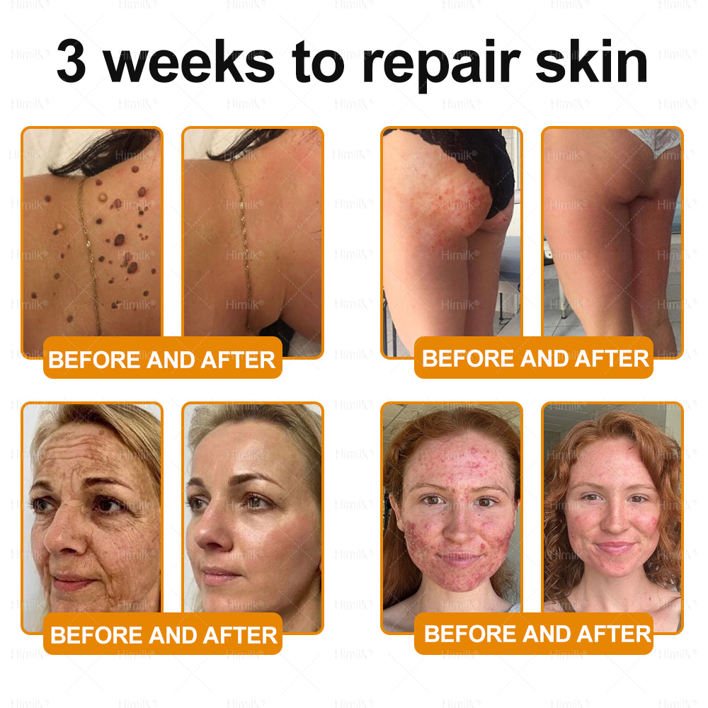 𝑯𝙞𝒎𝙞𝙡𝒌® ---One last chance! Grab this lucky find at 50% OFF!🔥180-day money back guarantee! Free air shipping!