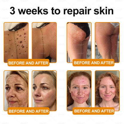 𝑯𝙞𝒎𝙞𝙡𝒌® ---One last chance! Grab this lucky find at 50% OFF!🔥180-day money back guarantee! Free air shipping!